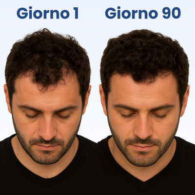 Ondivo Revita – Siero Anticaduta per Capelli