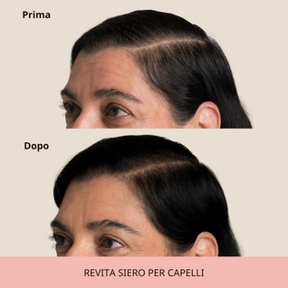 REVITA | Siero per capelli