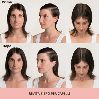 REVITA | Siero per capelli