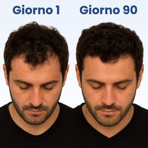 Ondivo Revita – Siero Anticaduta per Capelli
