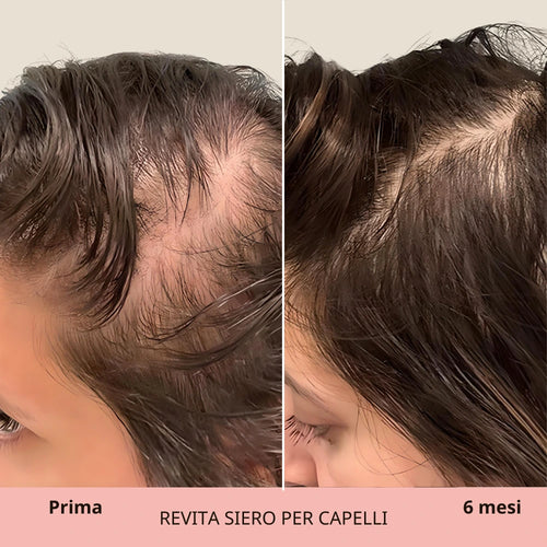 REVITA | Siero per capelli