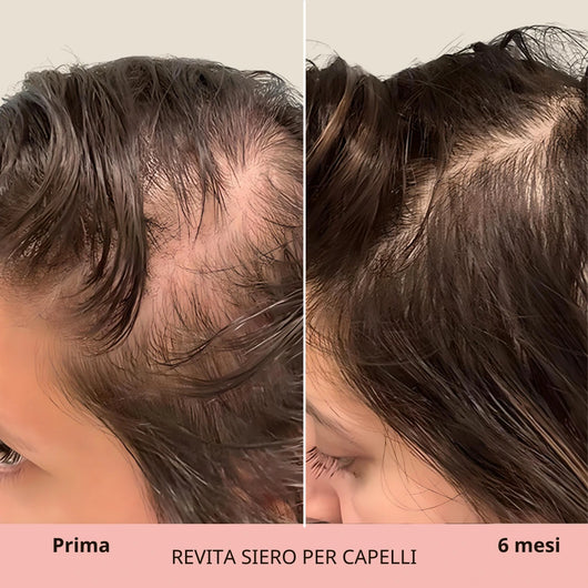 REVITA | Siero per capelli