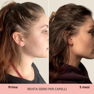REVITA | Siero per capelli