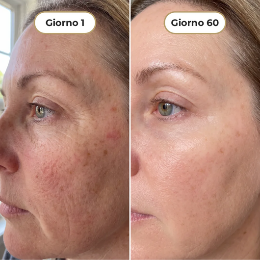 RePlump+| Maschera al Collagene