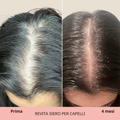 REVITA | Siero per capelli