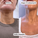 DermaGlow + | Sistema di Microinfusione - ONDIVO