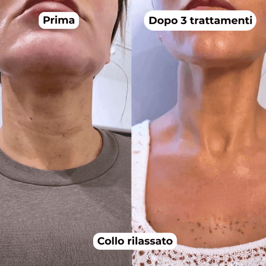 DermaGlow + | Sistema di Microinfusione - ONDIVO