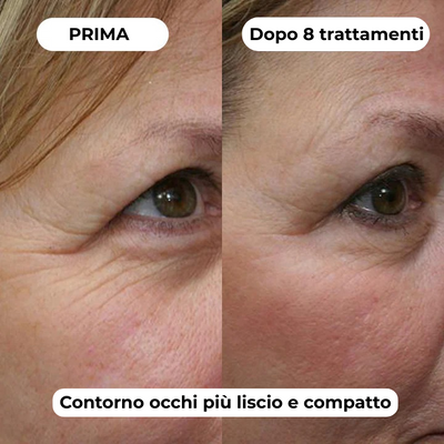 DermaGlow + | Sistema di Microinfusione